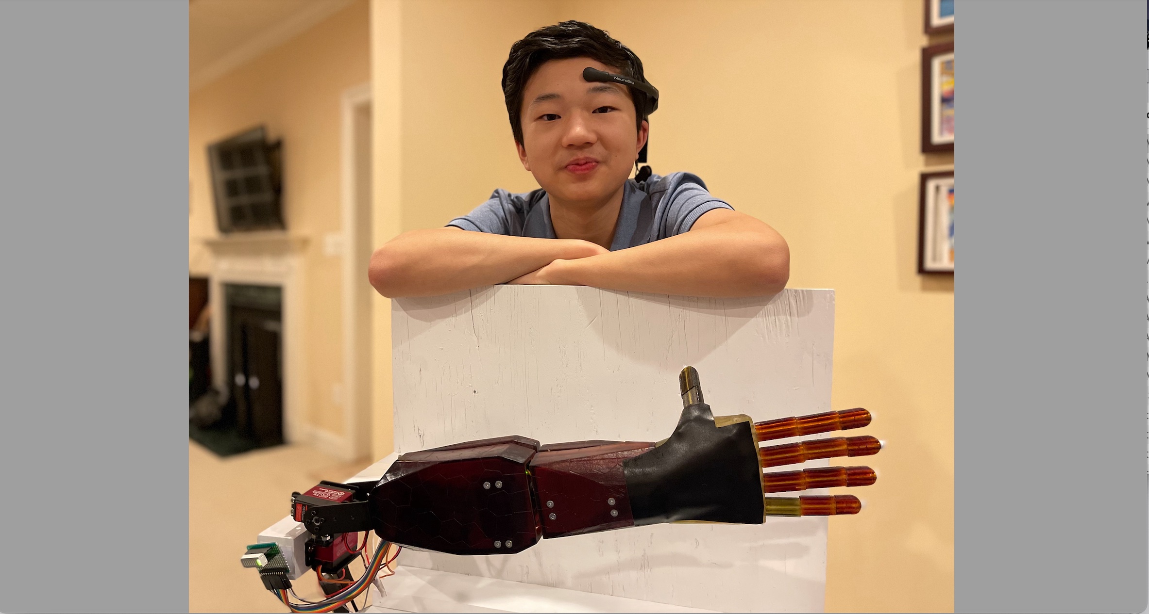 Neural Bionics